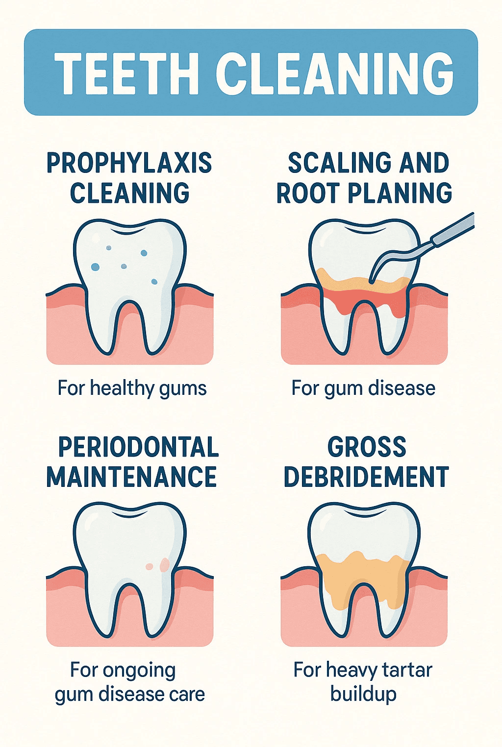 Infographic showing the four types of dental cleanings: prophylaxis cleaning for healthy gums, scaling and root planing for gum disease, periodontal maintenance for ongoing gum disease care, and gross debridement for heavy tartar buildup - Teeth Cleaning infographic